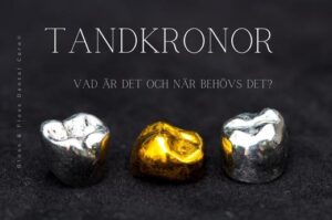 tandkronor behandling guide. Tre tandkronor från Gloss & Floss i olika material (metall och guld) på svart bakgrund