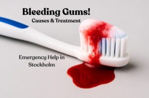 Bleeding gums treatment in Stockholm – toothbrush with blood foam at Gloss & Floss Dental Care.